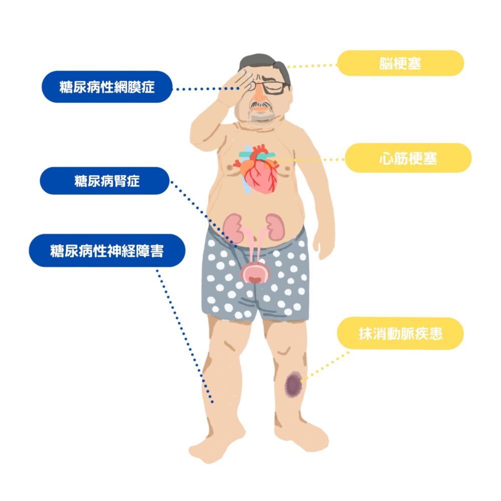 糖尿病網膜症とは
